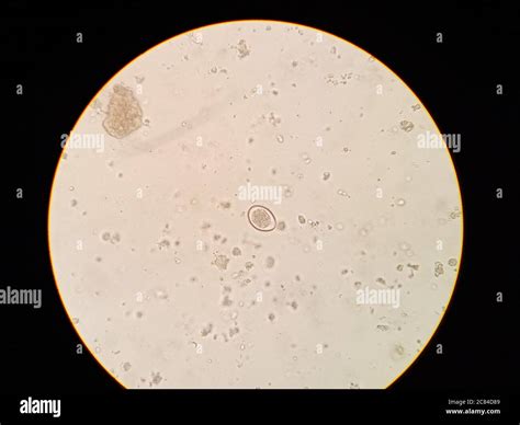  Isospora! En mikroskopisk parasit som kan sätta magen på prov